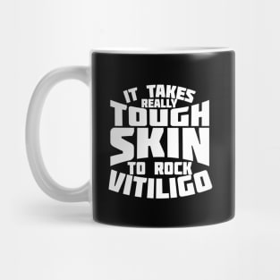 It Takes Really Tough Skin To Rock Vitiligo Mug